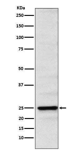 Neurogenin 2 (16K2) Rabbit Monoclonal Antibody