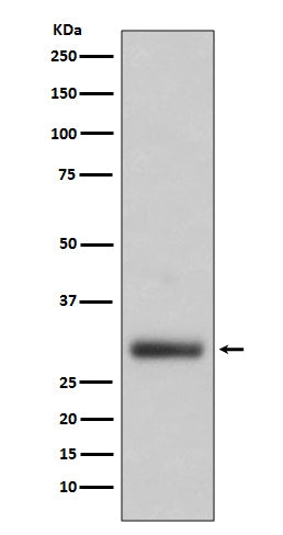 Neutrophil Elastase (9J14) Rabbit Monoclonal Antibody