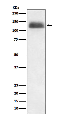 NFAT1 (11H19) Rabbit Monoclonal Antibody