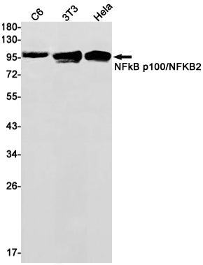 NF-κB p100/p52  (6Z19) Rabbit Monoclonal Antibody
