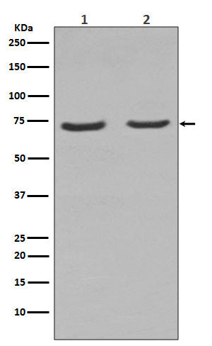 NGFR  (18V15) Rabbit Monoclonal Antibody