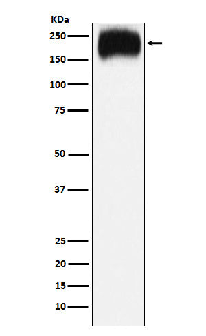 Niemann Pick C1 (4L10) Rabbit Monoclonal Antibody