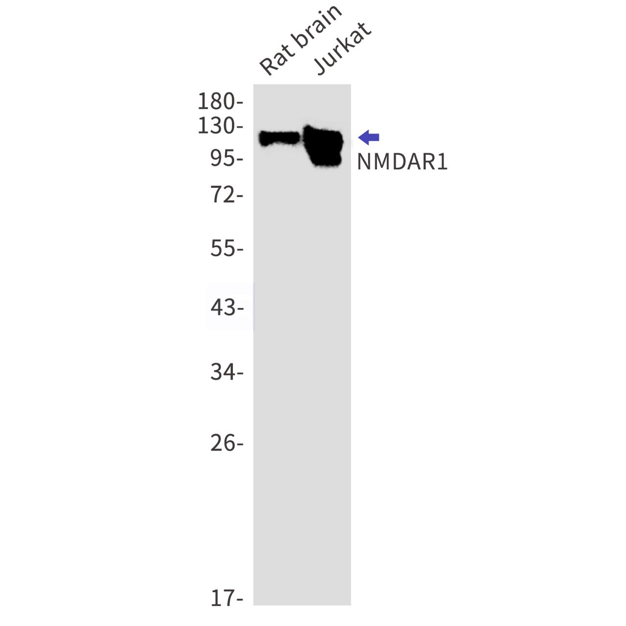 NMDAR1 (5R10) Rabbit Monoclonal Antibody