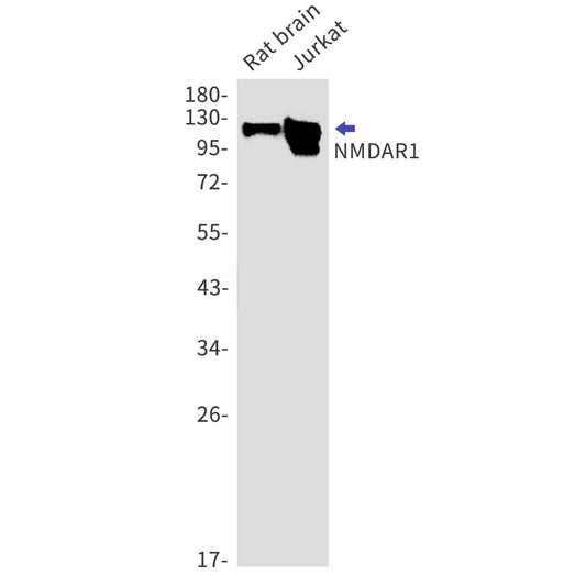 NMDAR1 (5R10) Rabbit Monoclonal Antibody