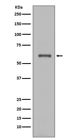 NOX4  (5T10) Rabbit Monoclonal Antibody