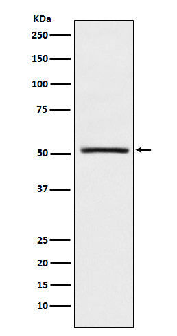 NR0B1 / DAX1 (13E3) Rabbit Monoclonal Antibody