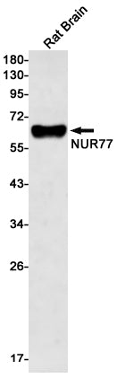 NUR77 (11I19) Rabbit Monoclonal Antibody