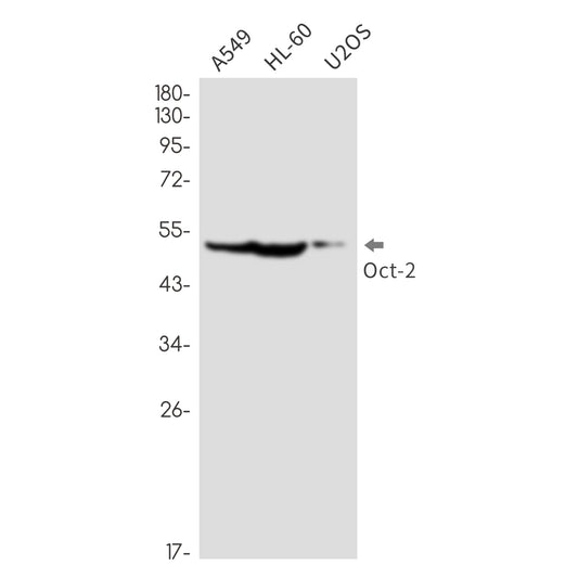 Oct-2 (14K1) Rabbit Monoclonal Antibody