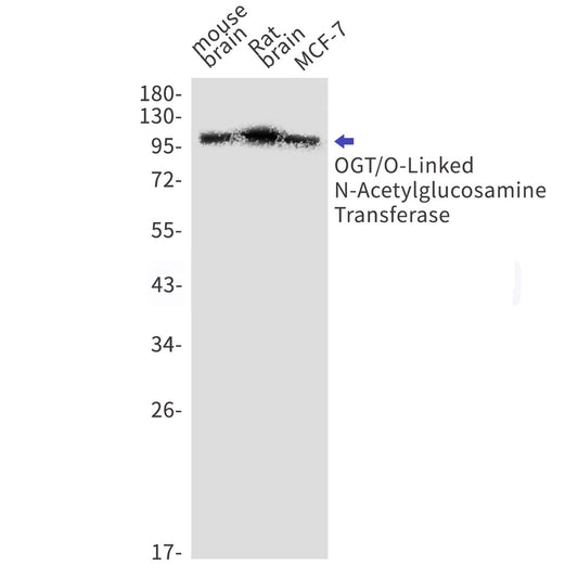 OGT (19A13) Rabbit Monoclonal Antibody