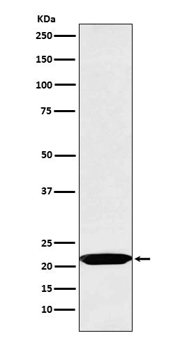 Oncostatin M (13Q11) Rabbit Monoclonal Antibody
