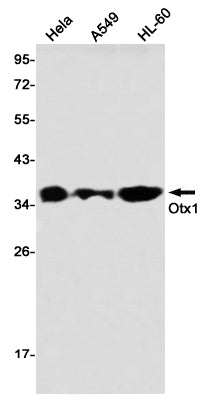 Otx1 (9X3) Rabbit Monoclonal Antibody