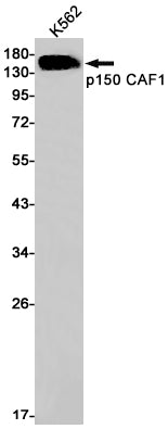 p150 CAF1 (19O17) Rabbit Monoclonal Antibody