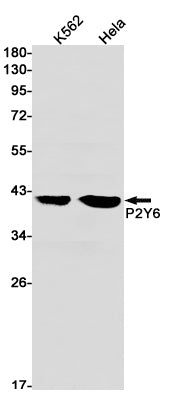 P2Y6 (15H8) Rabbit Monoclonal Antibody