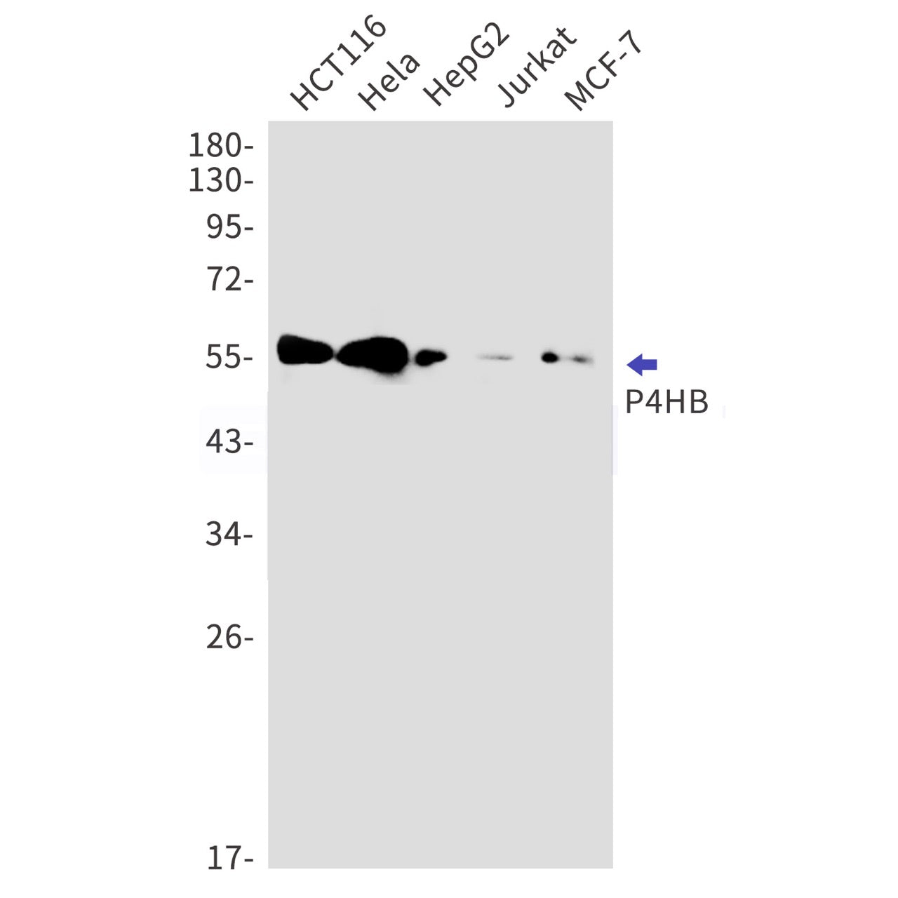 P4HB (15Y14) Rabbit Monoclonal Antibody