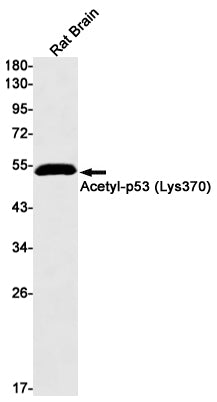 p53 (acetyl K370) (18F7) Rabbit Monoclonal Antibody