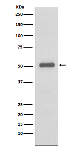 p57 Kip2  (12I5) Rabbit Monoclonal Antibody