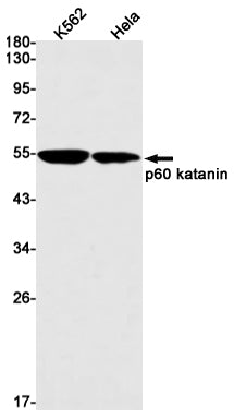 p60 katanin (5E5) Rabbit Monoclonal Antibody