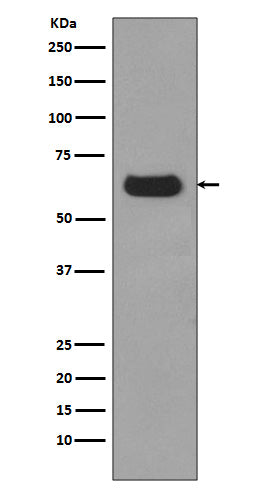 p62/SQSTM1  (12N5) Rabbit Monoclonal Antibody