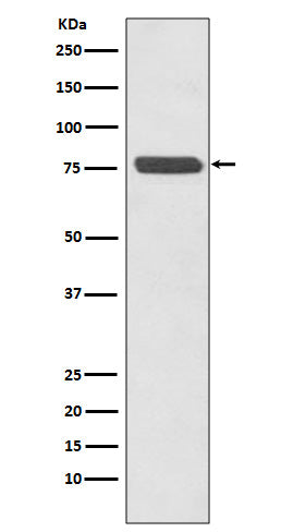 p63 (3J16) Rabbit Monoclonal Antibody
