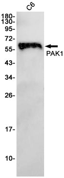 PAK1 (13Z7) Rabbit Monoclonal Antibody