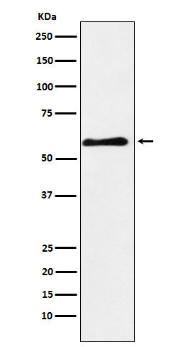 PAK3 (1O10) Rabbit Monoclonal Antibody
