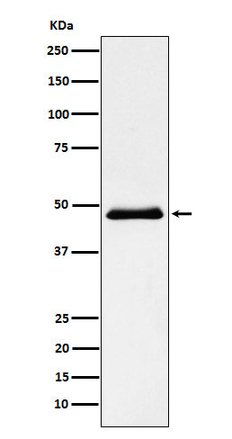 Pancreatic Lipase （PNLIP） (15J17) Rabbit Monoclonal Antibody