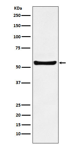 PAR2 (16O4) Rabbit Monoclonal Antibody