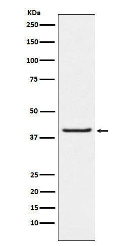 PAR4 (8M3) Rabbit Monoclonal Antibody