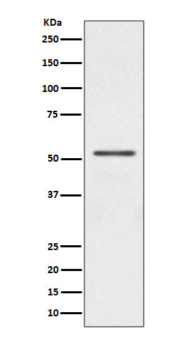 Parkin (17H13) Rabbit Monoclonal Antibody