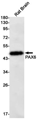 PAX6 (19K6) Rabbit Monoclonal Antibody
