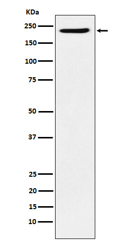 PBRM1 (8L14) Rabbit Monoclonal Antibody