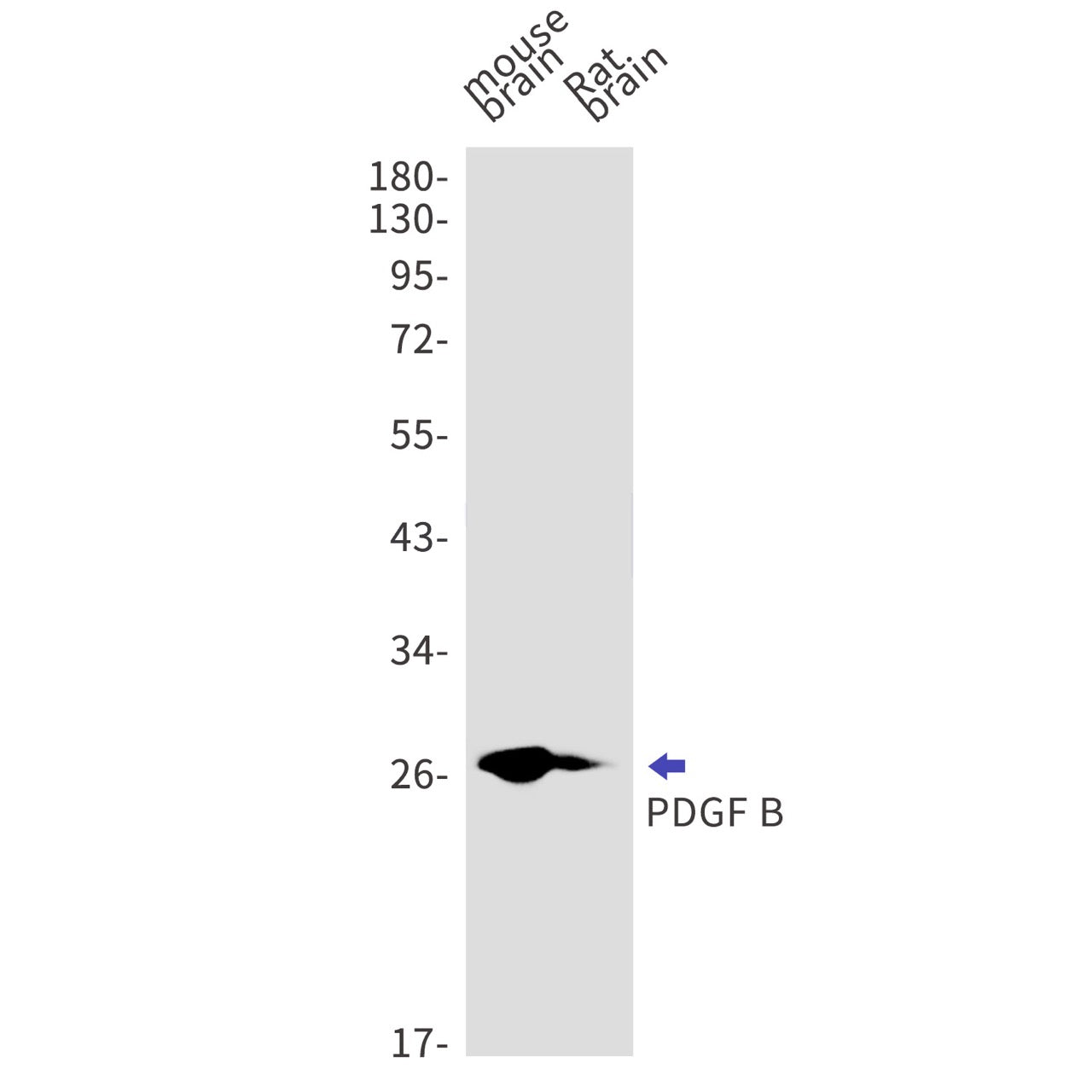 PDGF B (1X19) Rabbit Monoclonal Antibody