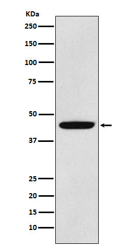 PDK1 (9S9) Rabbit Monoclonal Antibody