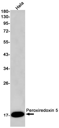 Peroxiredoxin 5 (18K18) Rabbit Monoclonal Antibody