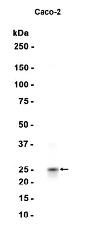 PGDH (9T2) Rabbit Monoclonal Antibody