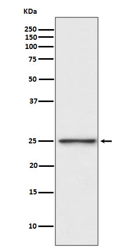 PGP9.5 (5O2) Rabbit Monoclonal Antibody
