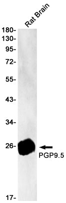 PGP9.5 (9U4) Rabbit Monoclonal Antibody