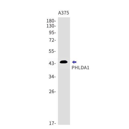 PHLDA1 (11J6) Rabbit Monoclonal Antibody