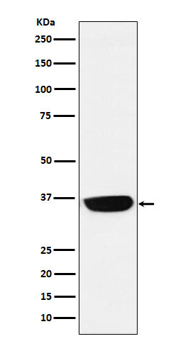 PHOX2B (7H13) Rabbit Monoclonal Antibody