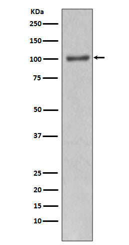 PI 3 kinase p110 alpha (8X14) Rabbit Monoclonal Antibody