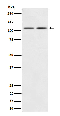 PI3 Kinase p110 beta (11D3) Rabbit Monoclonal Antibody