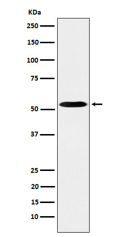 PKA R2 (2D7) Rabbit Monoclonal Antibody