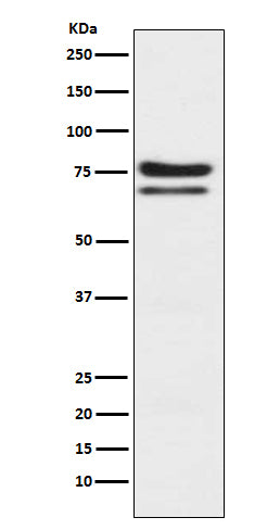 PKC epsilon (3H3) Rabbit Monoclonal Antibody