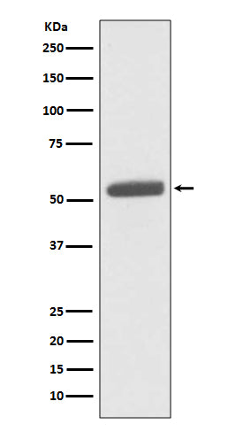 PKM2 (1W18) Rabbit Monoclonal Antibody