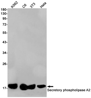 PLA2G2A (17I12) Rabbit Monoclonal Antibody