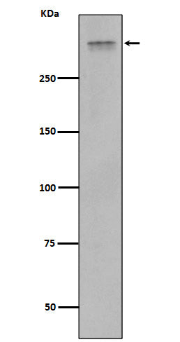 Plectin (16X18) Rabbit Monoclonal Antibody