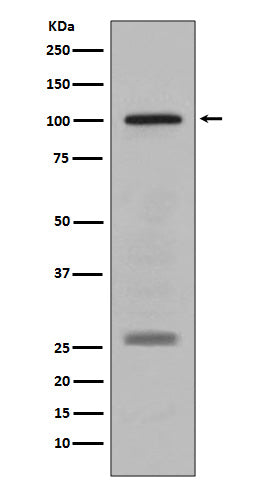 PMEL17 / GP100 (2Z15) Rabbit Monoclonal Antibody