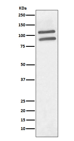 PML (11A3) Rabbit Monoclonal Antibody