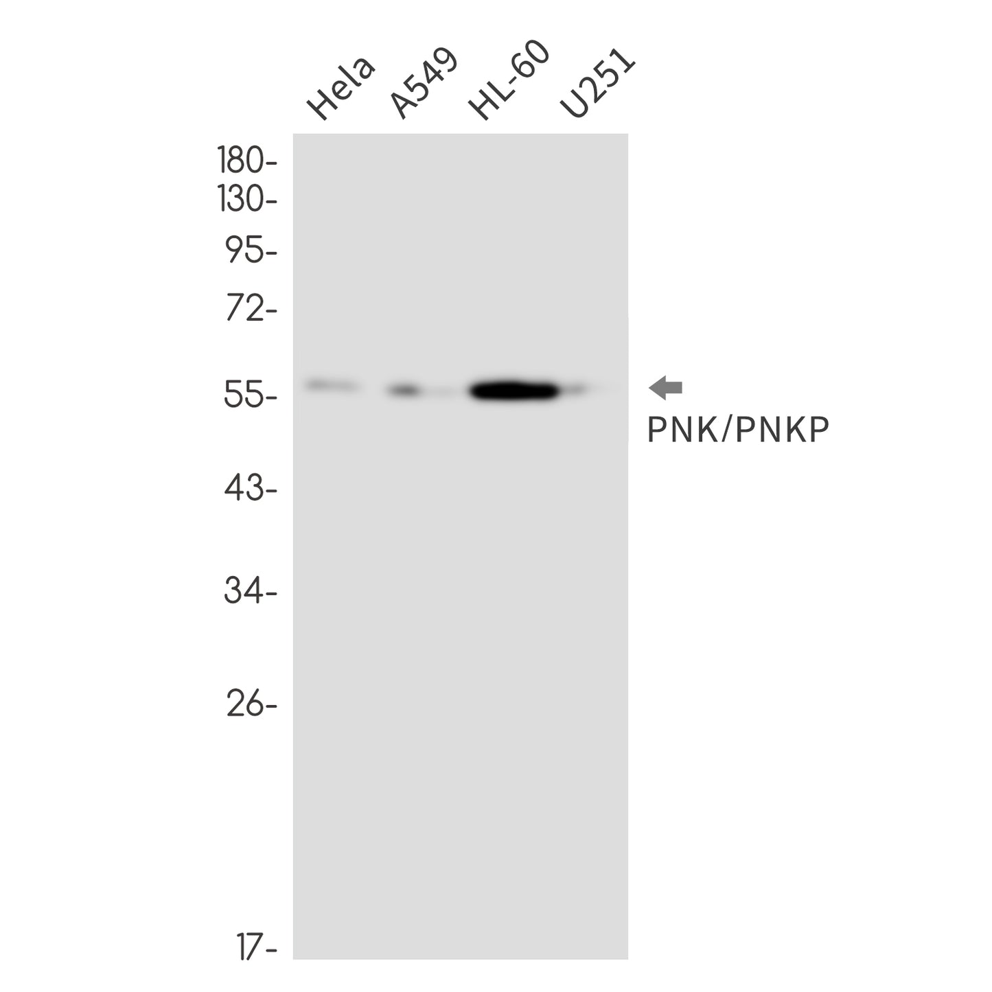 PNK / PNKP (12Y10) Rabbit Monoclonal Antibody