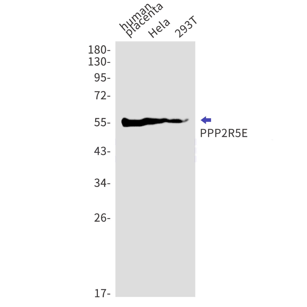PPP2R5E (16A15) Rabbit Monoclonal Antibody
